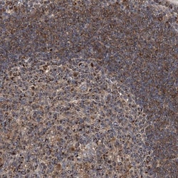 TACI/TNFRSF13B/CVID Antibody, Novus Biologicals:Antibodies:Primary Antibodies